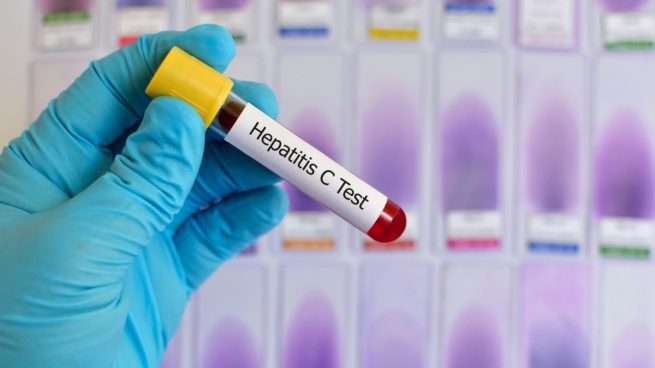 La OMS confirma más de 160 casos de la nueva hepatitis aguda infantil en 11 países