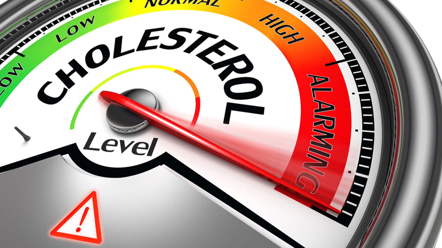 El colesterol elevado es uno de los factores de riesgo cardiovascular.