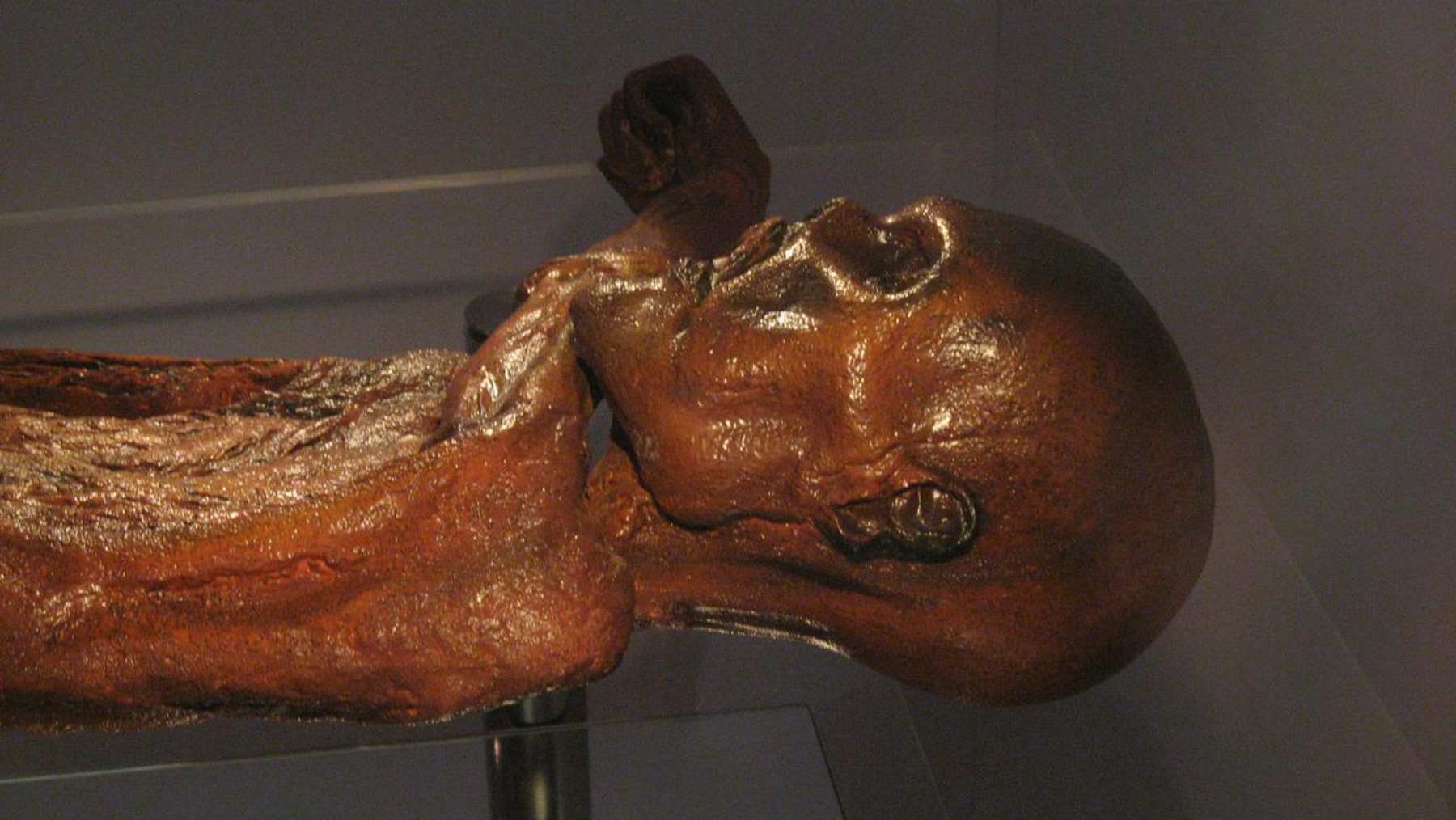 La maldición de Ötzi