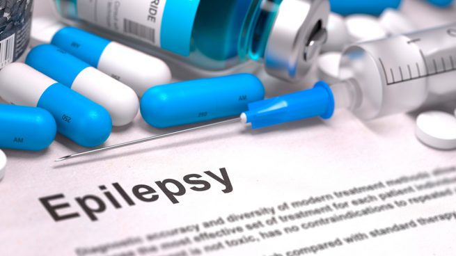 Dos tercios de los pacientes con epilepsia se controlan sólo con medicación