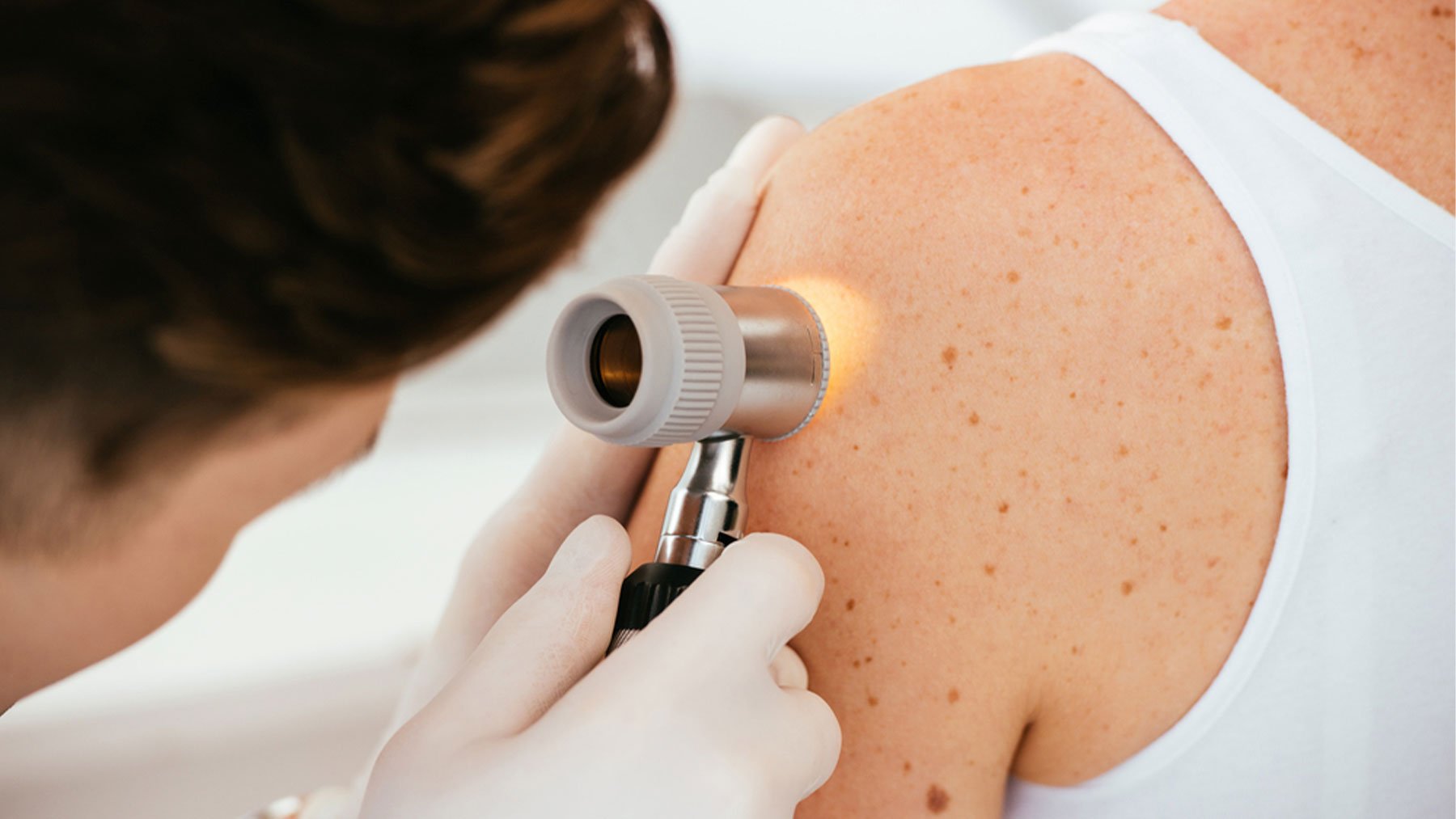 Dra. Elena Godoy, dermatóloga: No hay bronceado saludable