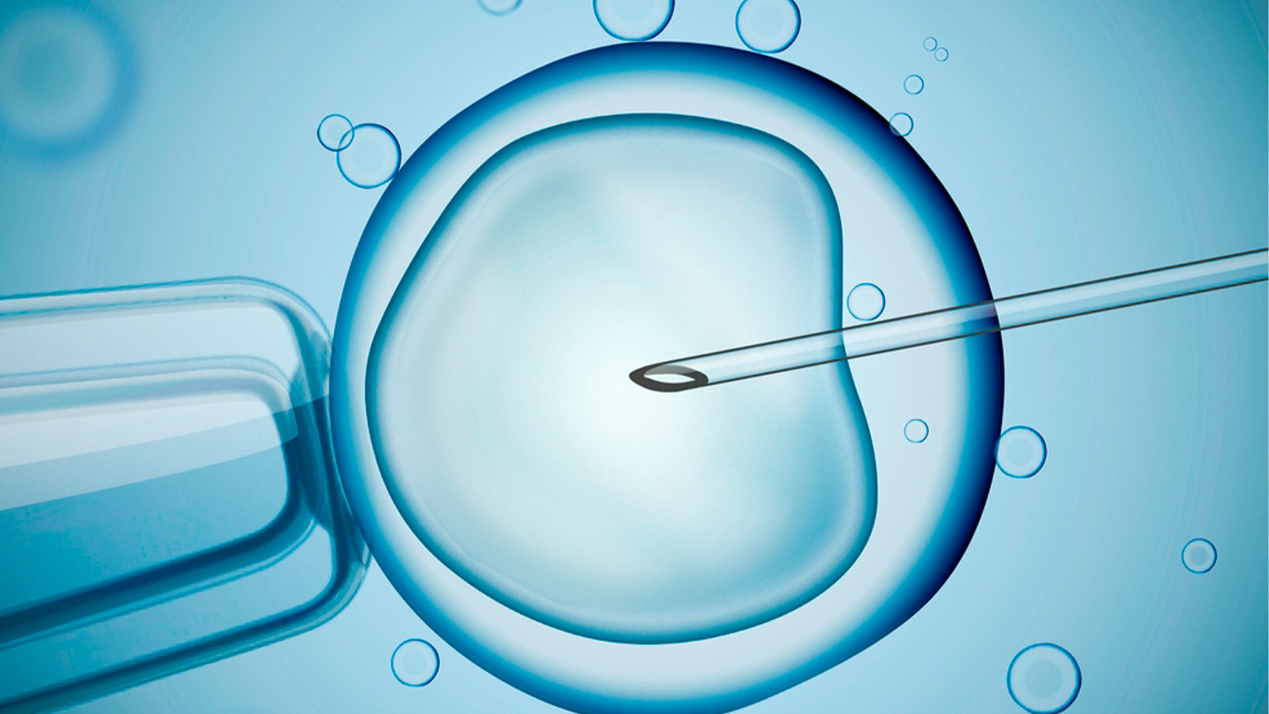 En el marco del proceso FIV una de las decisiones pasa por decidir la transferencia de un solo embrión o dos.