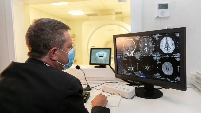 Resonancia magnética con láser: la nueva opción para tratar la epilepsia