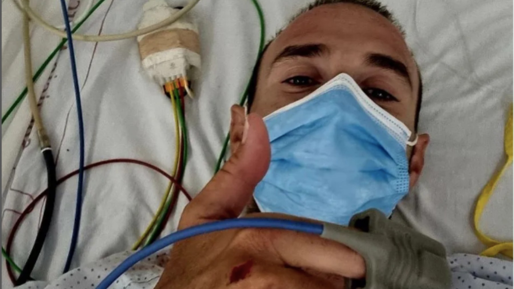 Alejandro Valverde, en el hospital tras ser atropellado. (Foto: Alejandro Valverde)