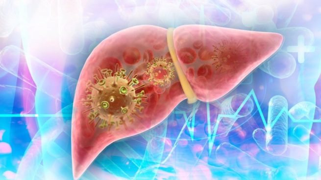 Hepatitis de origen desconocido