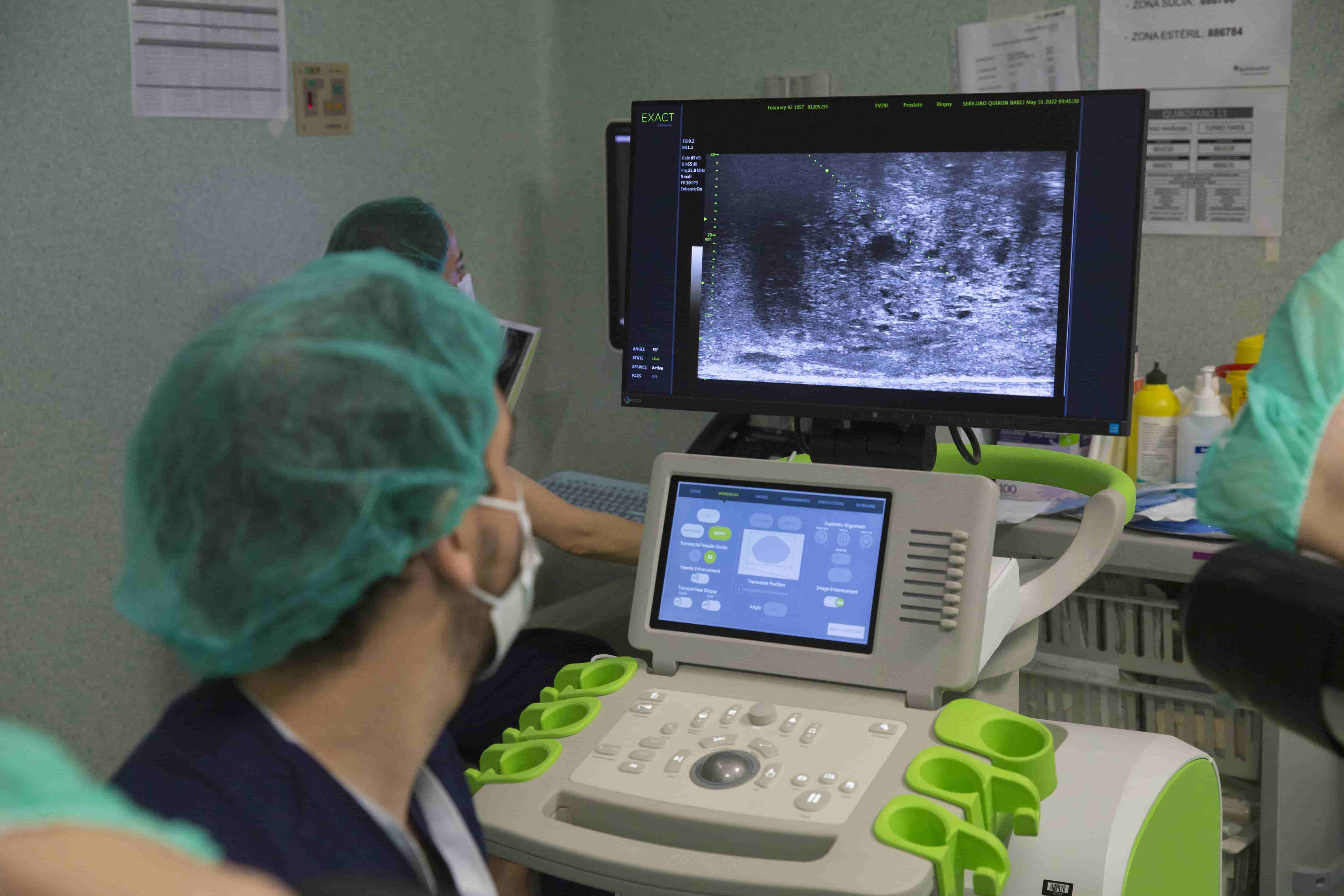 Quirónsalud Barcelona pionero en Cataluña en el uso de un ecógrafo de microultrasonidos para las biopsias de próstata