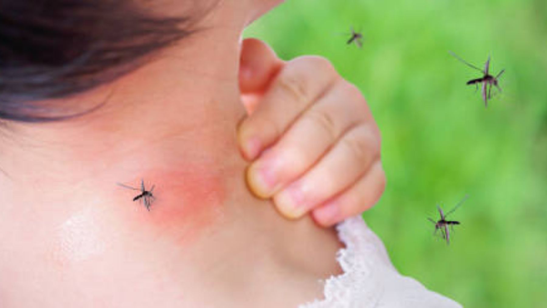 Descubre cómo acabar con las cicatrices por las picaduras de mosquitos