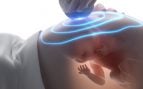Fertilidad