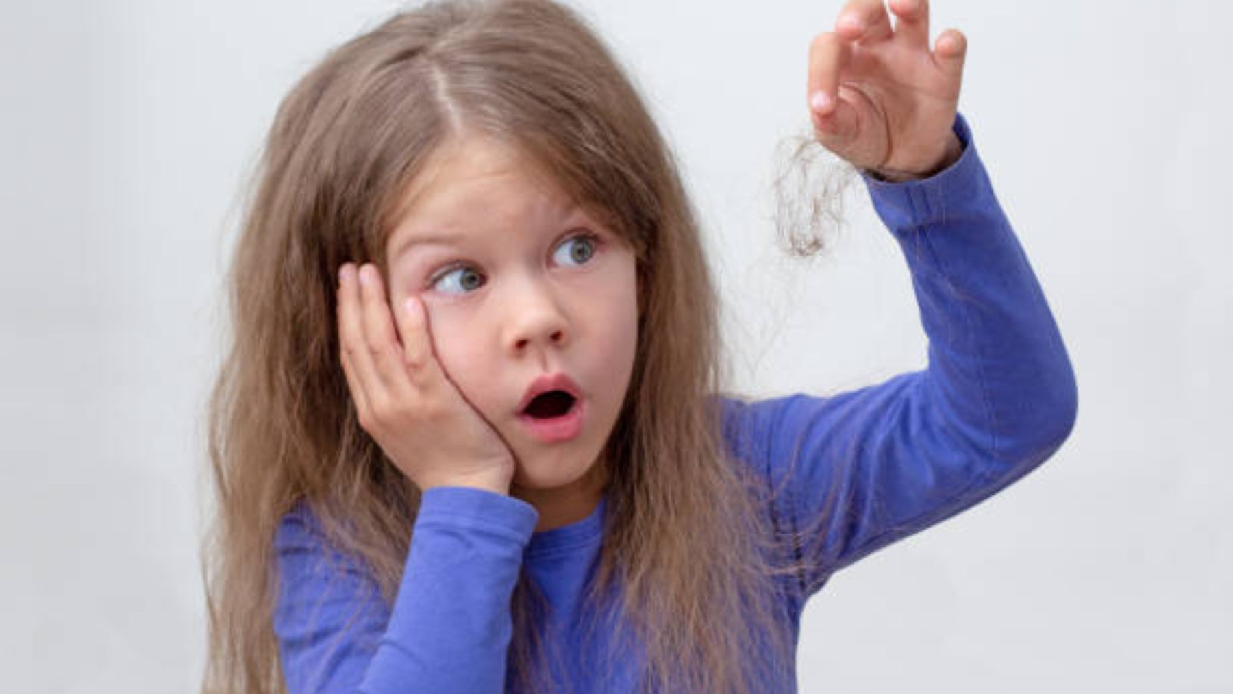 Cómo tratar la alopecia en los niños