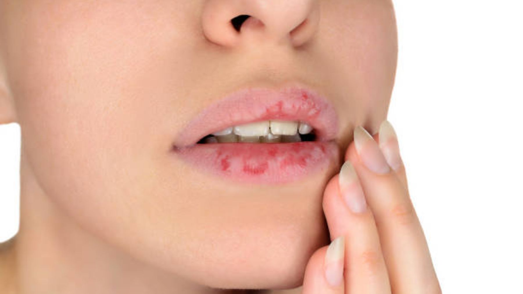 Los mejores remedios para tratar tus labios agrietados