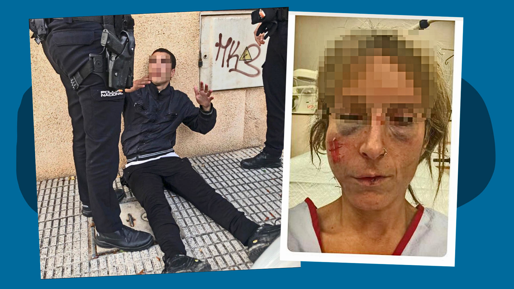 Operan de fracturas en la cara a la mujer apaleada por un marroquí