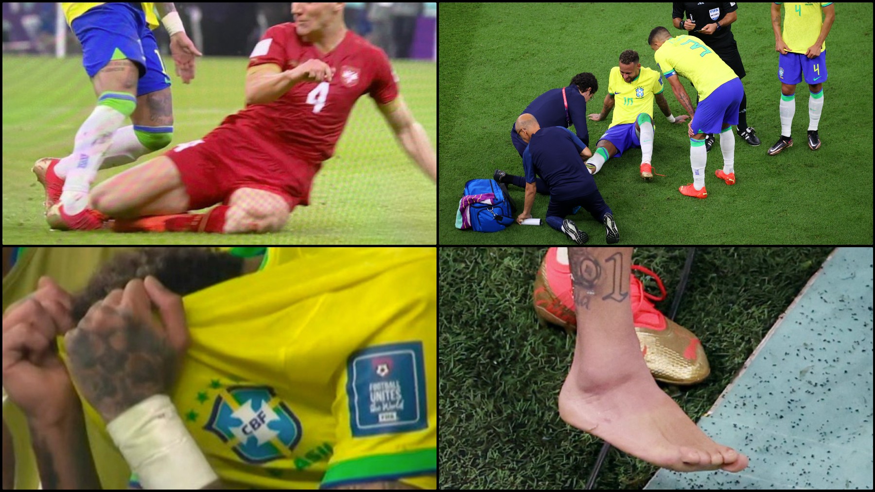 El tobillo de Neymar, tras lesionarse en el Brasil – Serbia.
