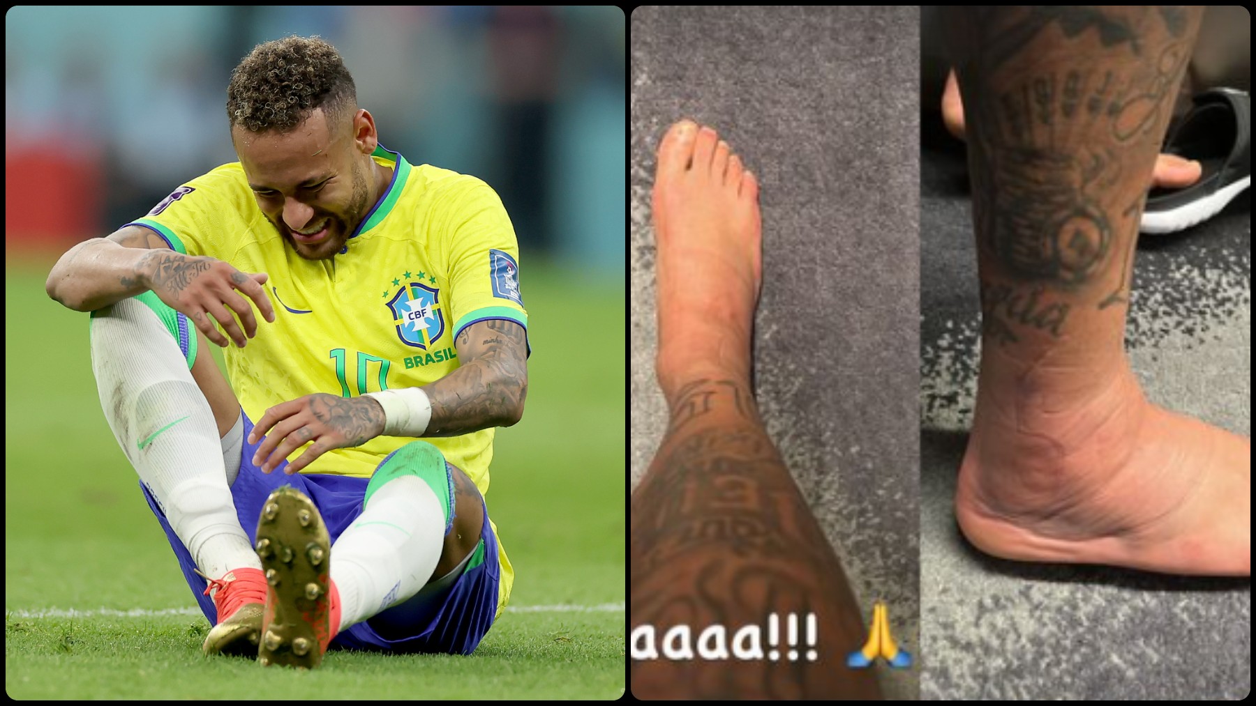 Así está el tobillo de Neymar. (Getty)