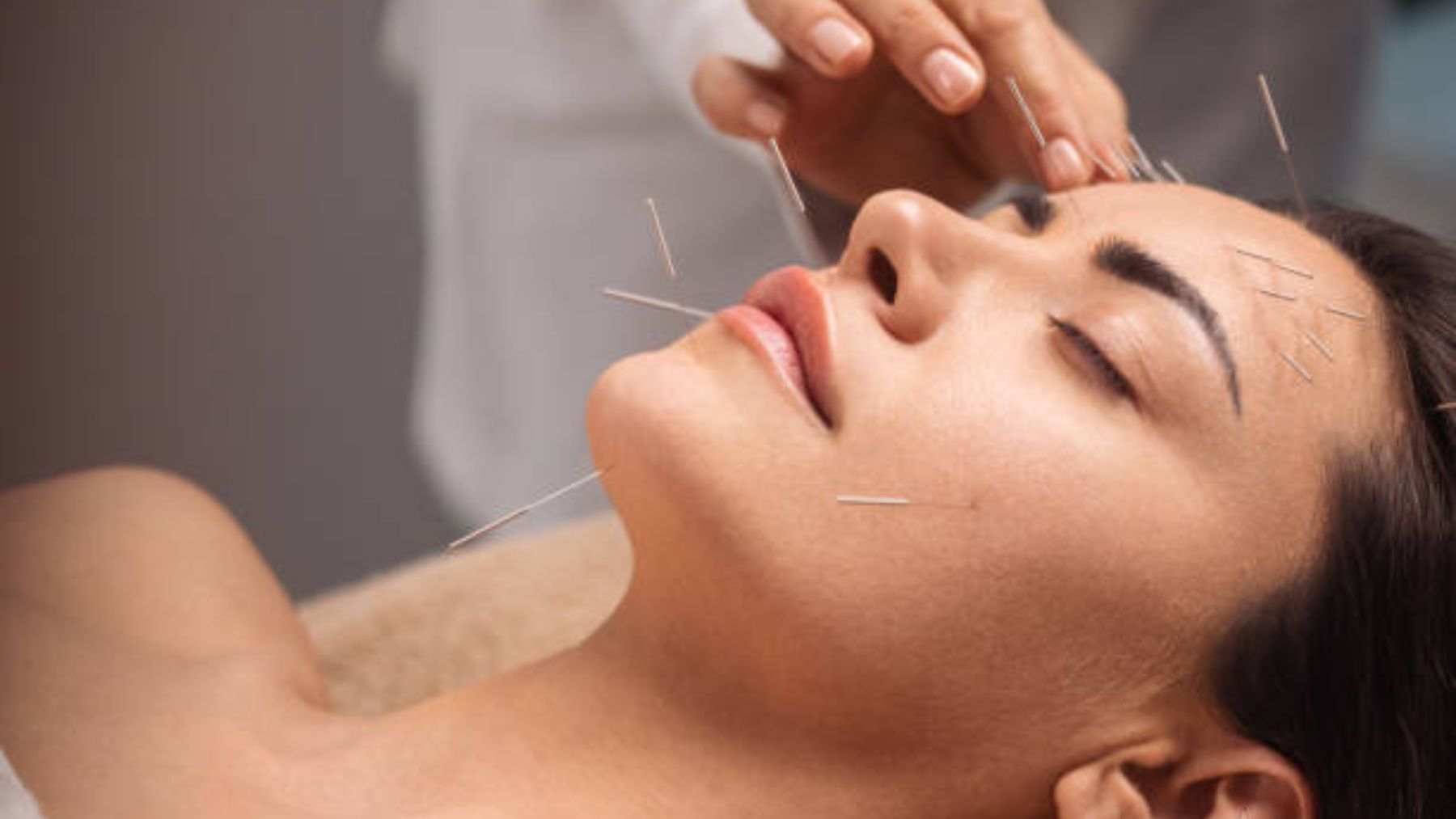 Descubre cómo te puede funcionar la acupuntura con las náuseas matutinas