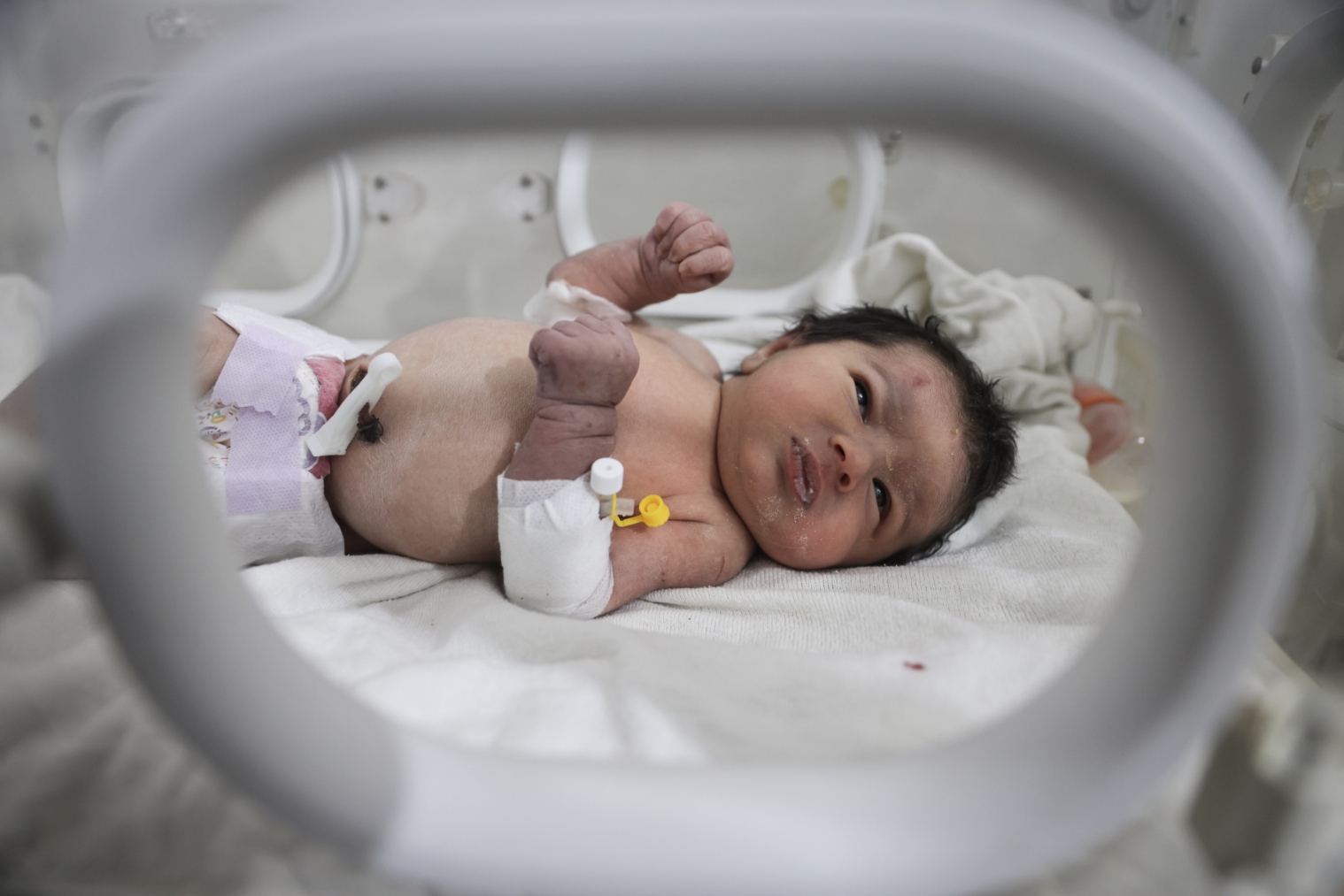 Aya, la bebé rescatada bajo los escombros en Siria