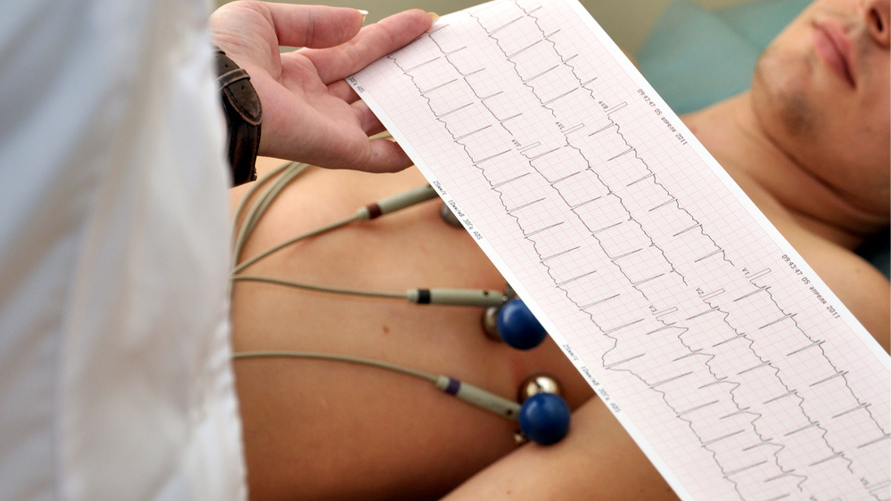 El electrocardiograma es una prueba útil de cribado cardiovascular.