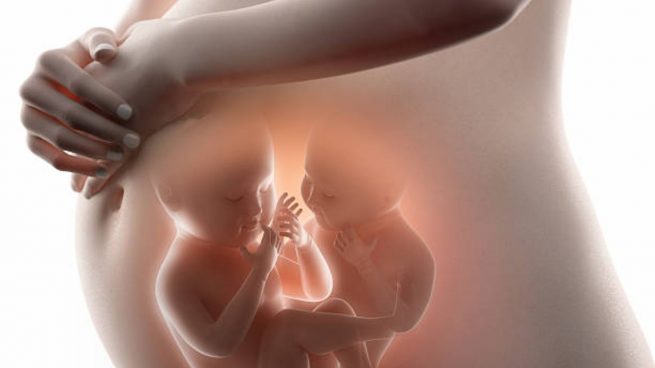 Embarazo gemelar monocoriónico