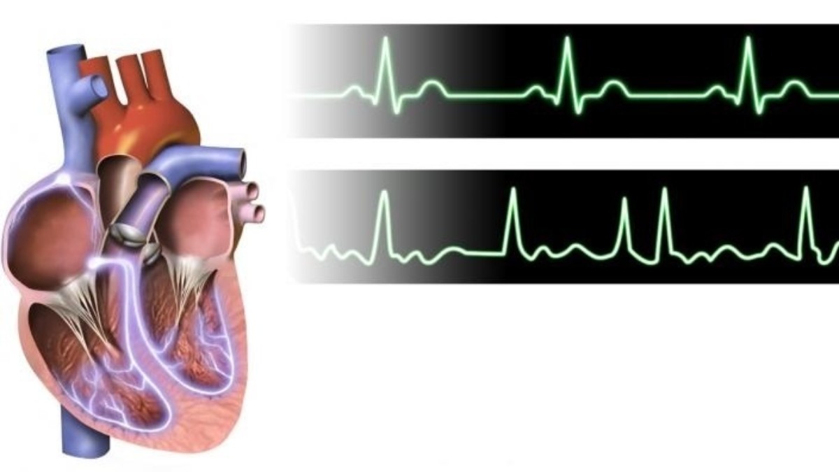Corazón, electrocardiograma, cardiaco.