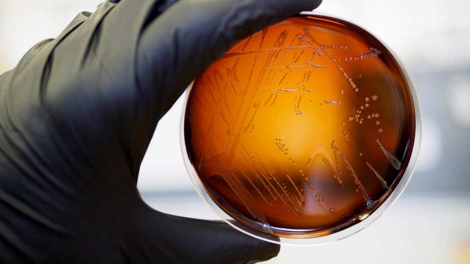 Riesgos y peligros de las bacterias al contacto con el agua