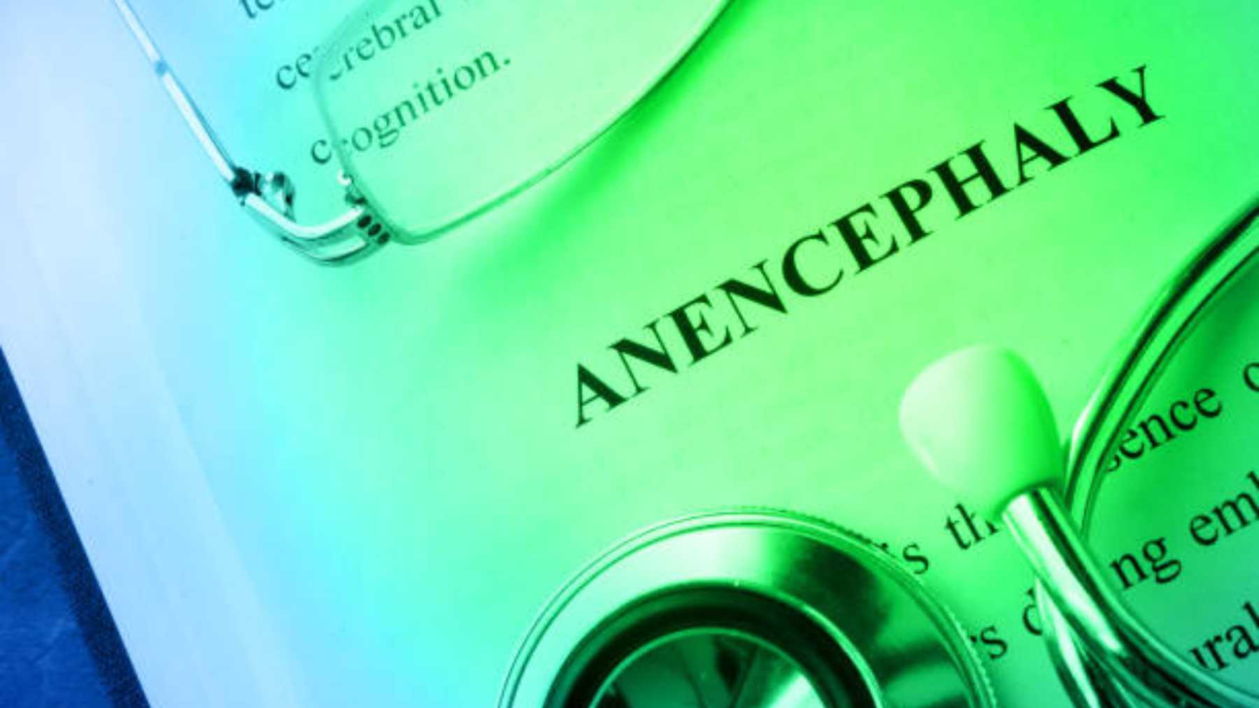 Anencefalia