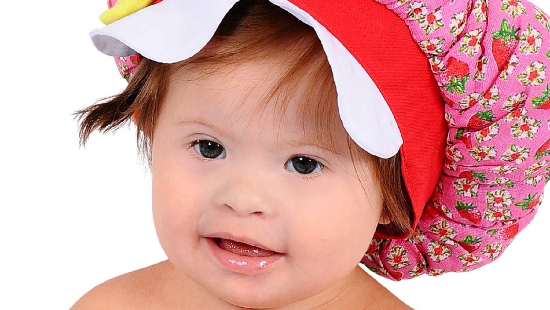 Nacen cada vez menos niños con síndrome de Down