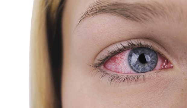 Estos expertos te aconsejan cómo reducir la alergia primaveral en los ojos