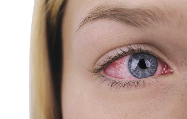 Estos expertos te aconsejan cómo reducir la alergia primaveral en los ojos