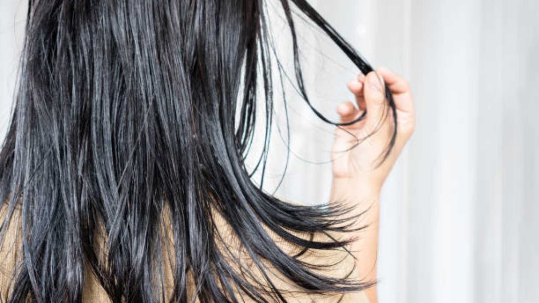 Los mejores remedios para tratar un cabello grasa con caspa