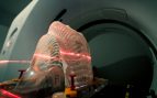 Radioterapia