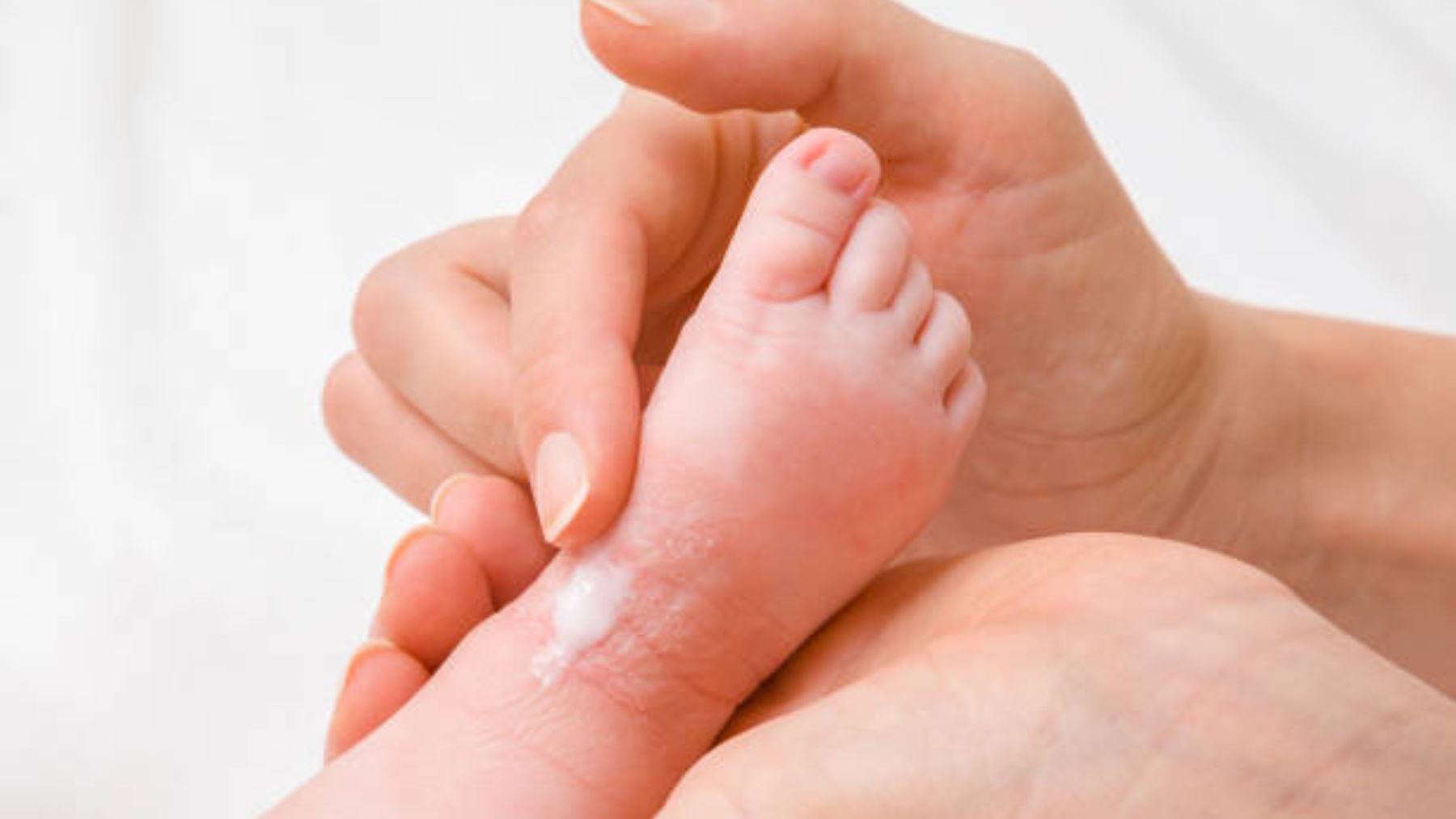 Cómo debes tratar la piel atópica en el bebé