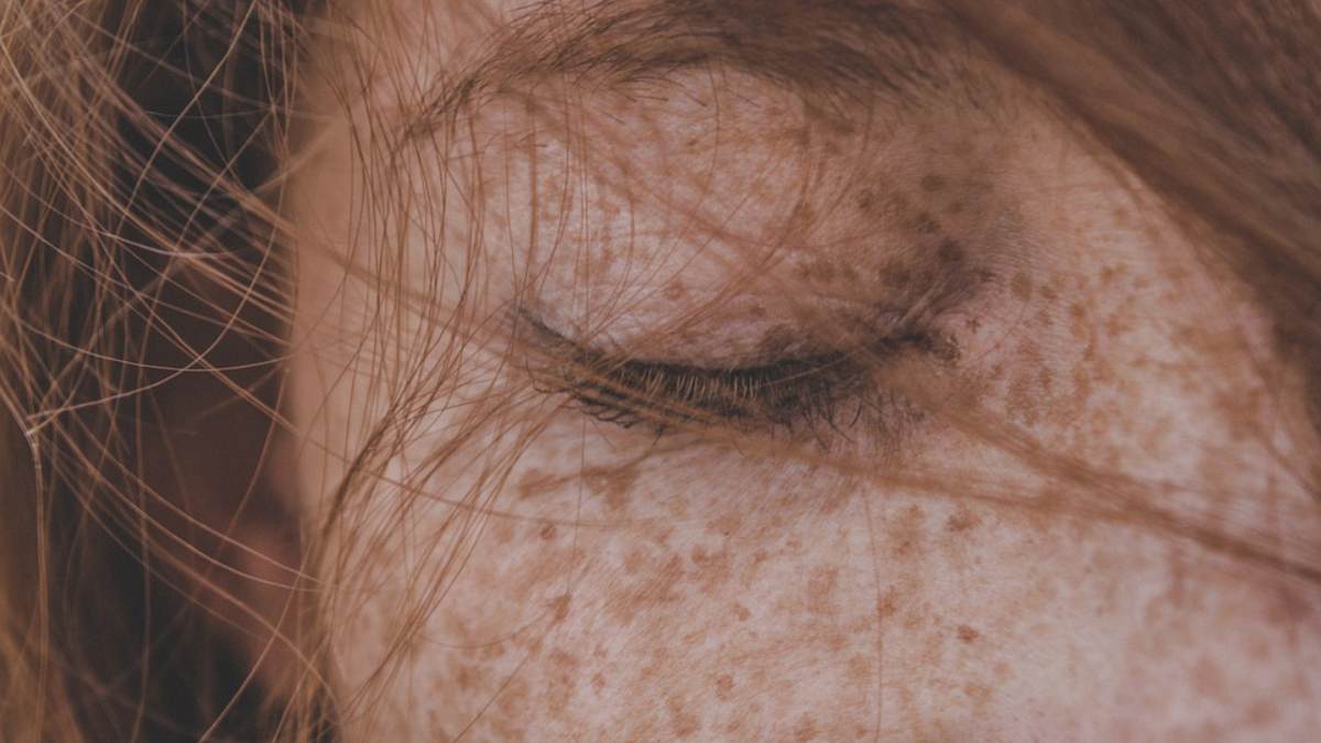 En España se diagnostican más de 78.000 nuevos casos de cáncer de piel al año
