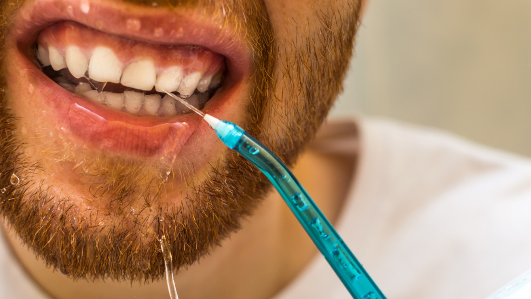 Какой врач проводит чистку зубов