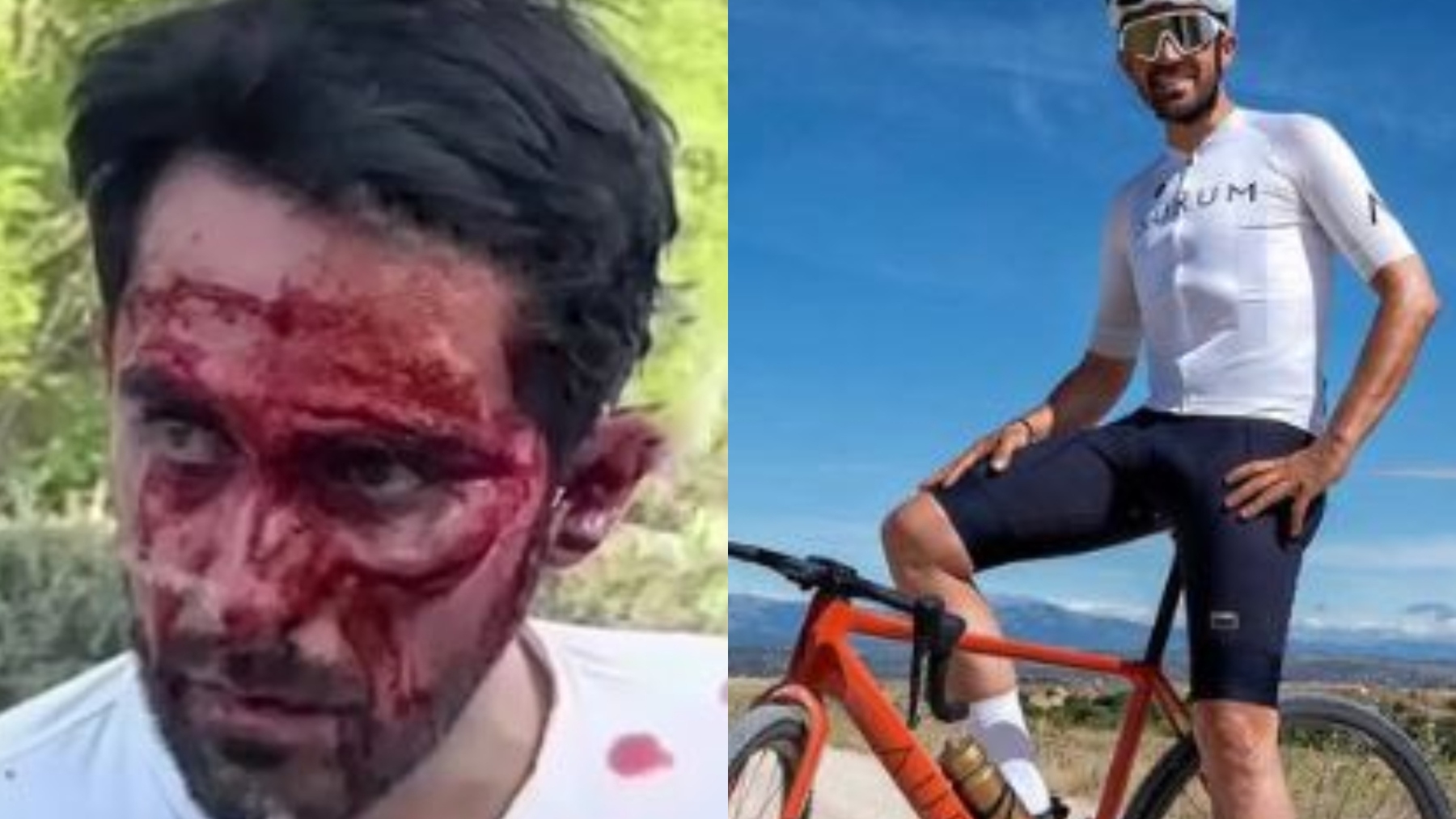 Alberto Contador antes y después de la caída en China.