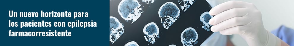Un nuevo horizonte para los pacientes con epilepsia farmacorresistente