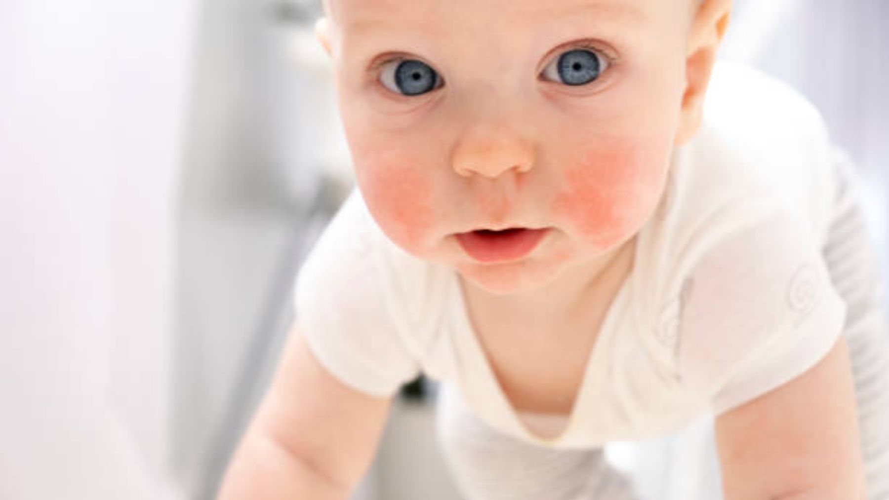 Los motivos por los que el bebé tiene las mejillas rojas