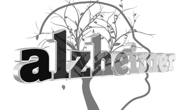 Signos del alzheimer