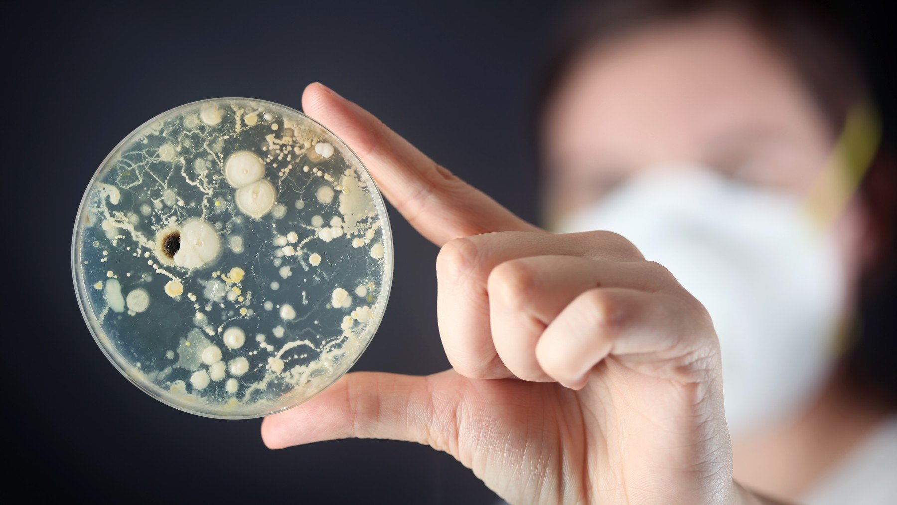 Las bacterias multirresistentes son un desafío para los científicos.