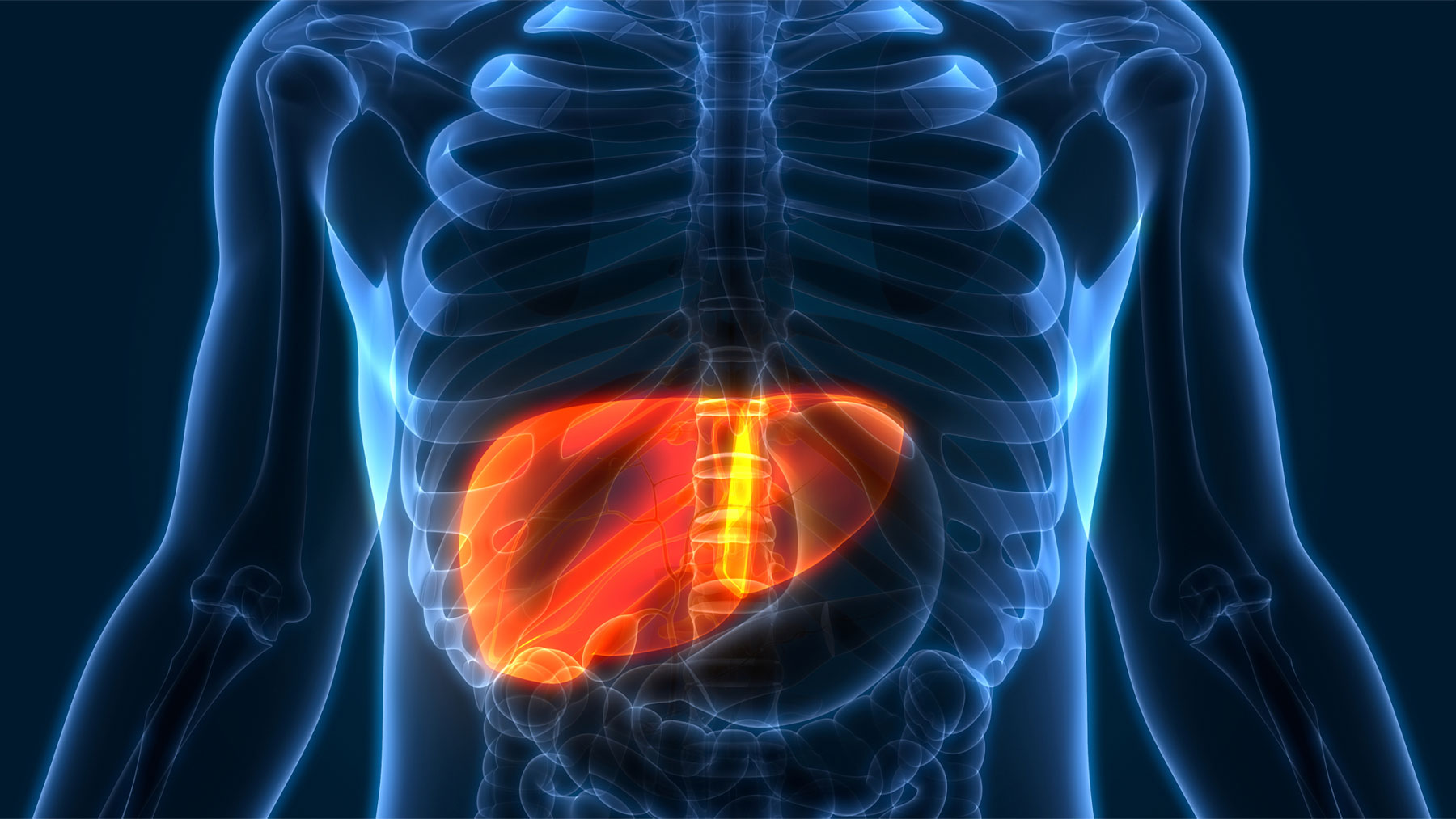 El cáncer de hígado es el sexto tumor maligno más comúnmente diagnosticado en el mundo.
