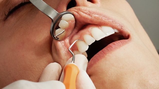 El futuro de los dentistas está a punto de cambiar. Científicos descubren el primer fármaco 'crece dientes'