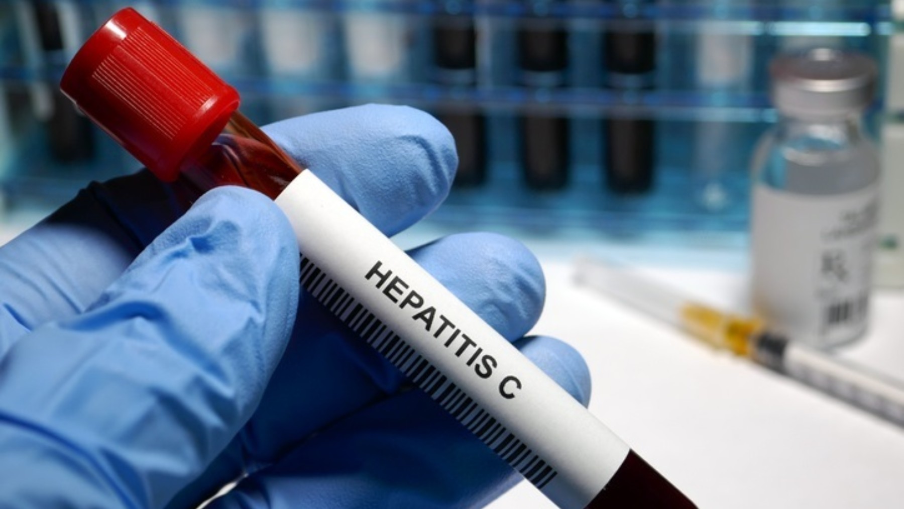 Prueba de Hepatitis C.