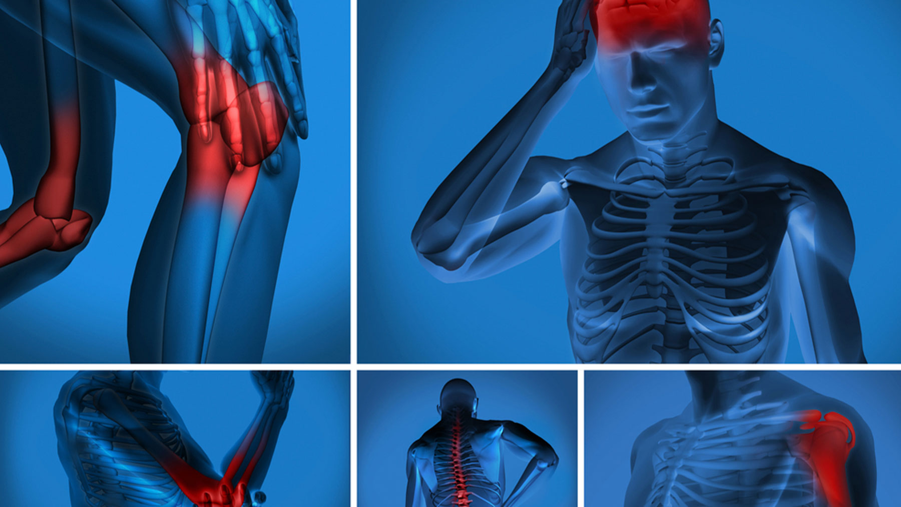 Más del 60% de las personas que padecen dolor crónico padecen dolor neuropático.