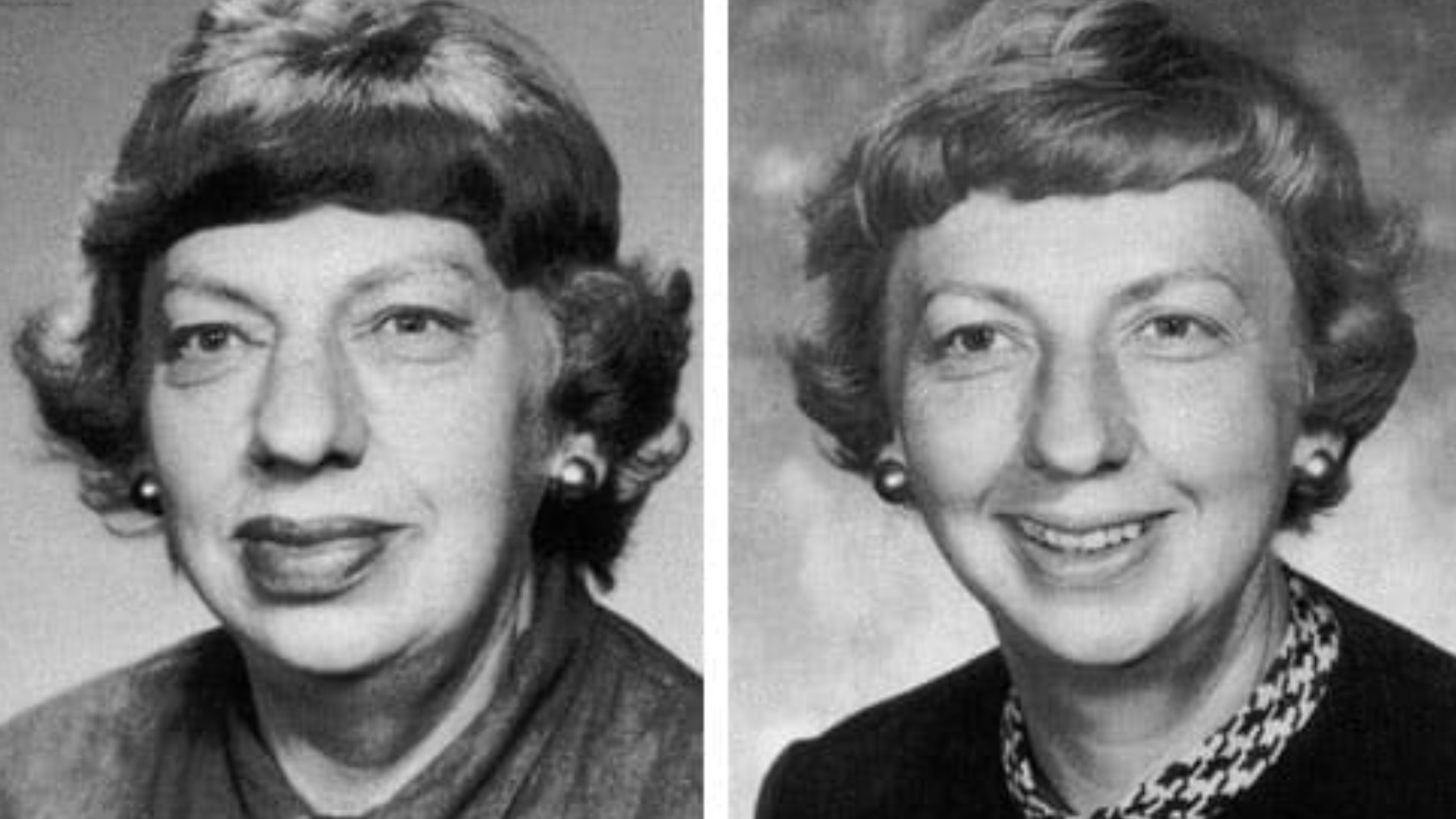 Una paciente y dos imágenes que muestran sus cambios físicos entre 1977 y 1988.
