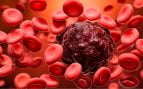 leucemia
