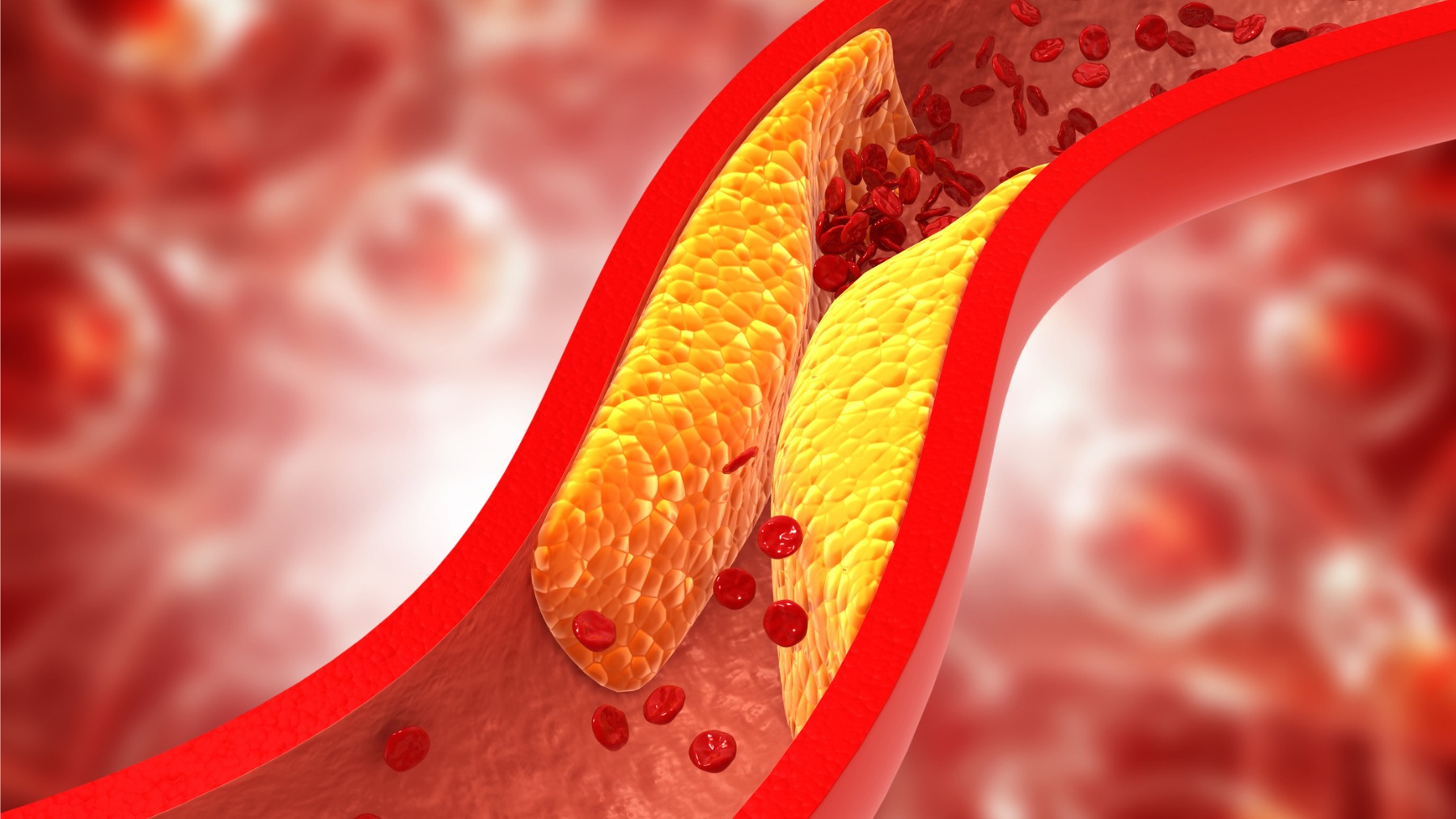El colesterol alto es uno de los principales problemas de salud de gran parte de la población que lucha para mantenerlo a raya