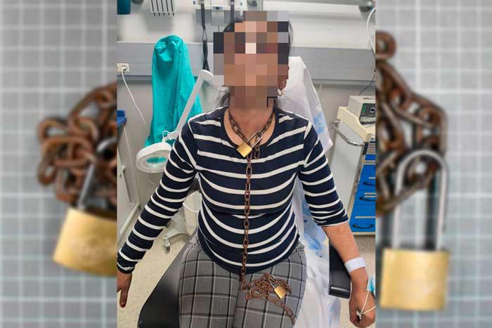 En este estado llegó la mujer encadenada al hospital tras huir de su agresor.