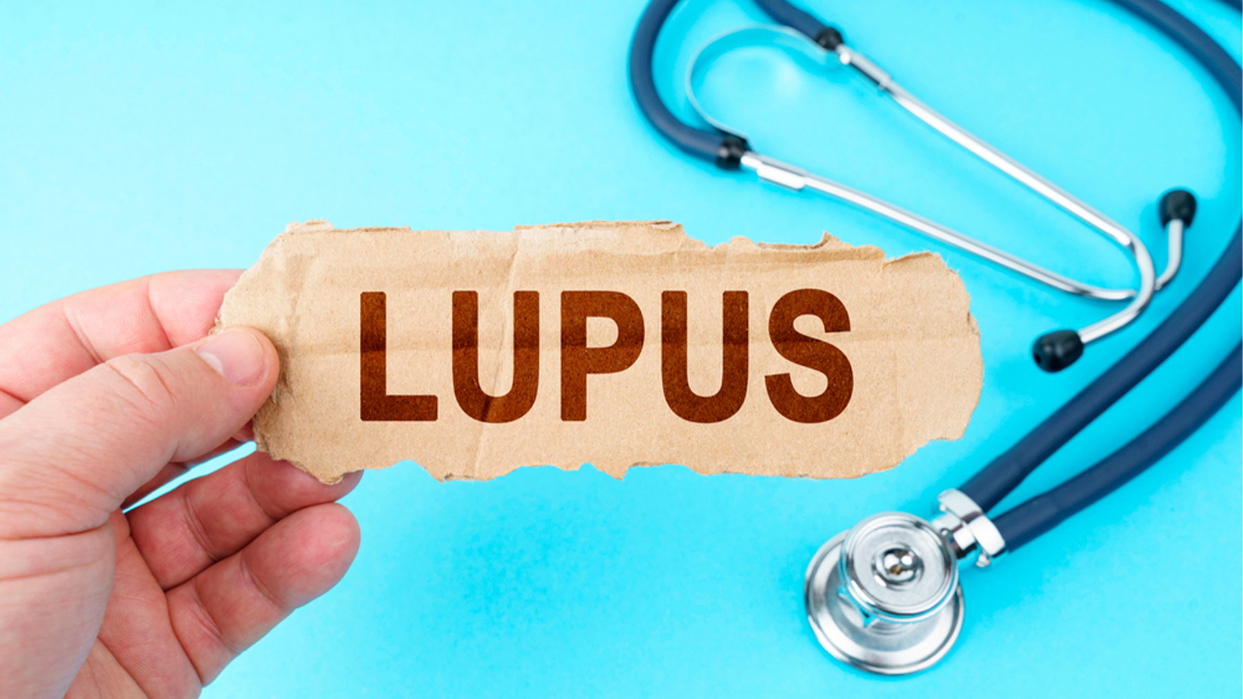 El lupus puede afectar a diferentes órganos y sistemas.