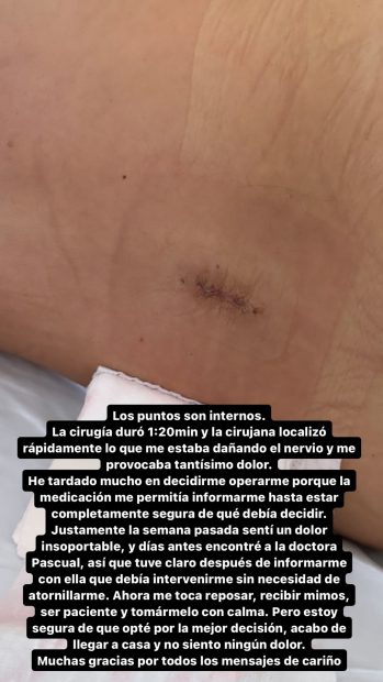 Nagore Robles muestra las heridas de su operación de espalda (Instragram)