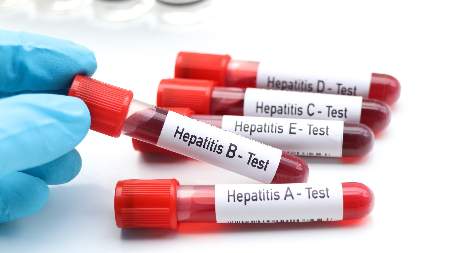 Test de distintos tipos de hepatitis.