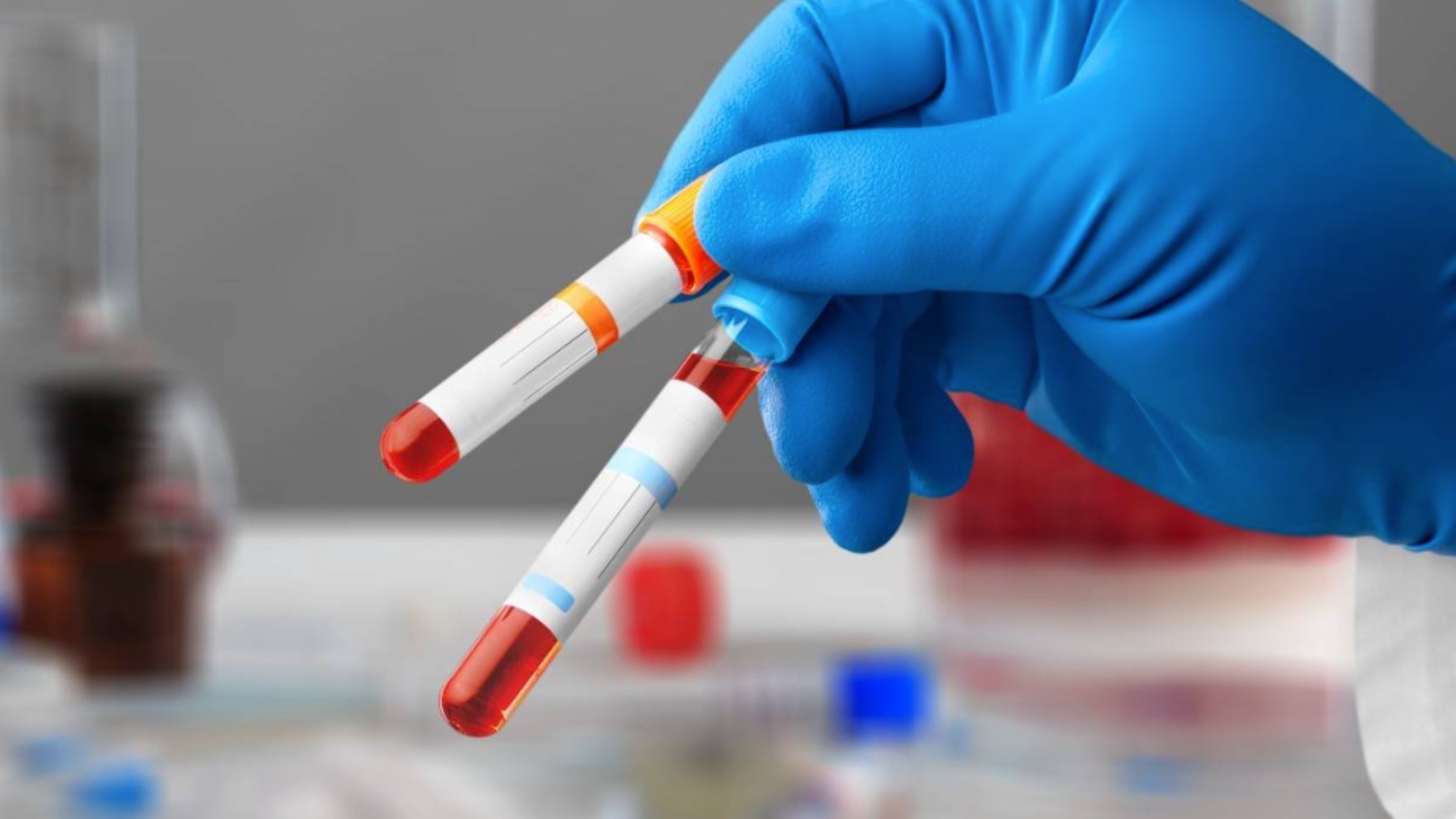 Distintas muestras de sangre en un laboratorio.