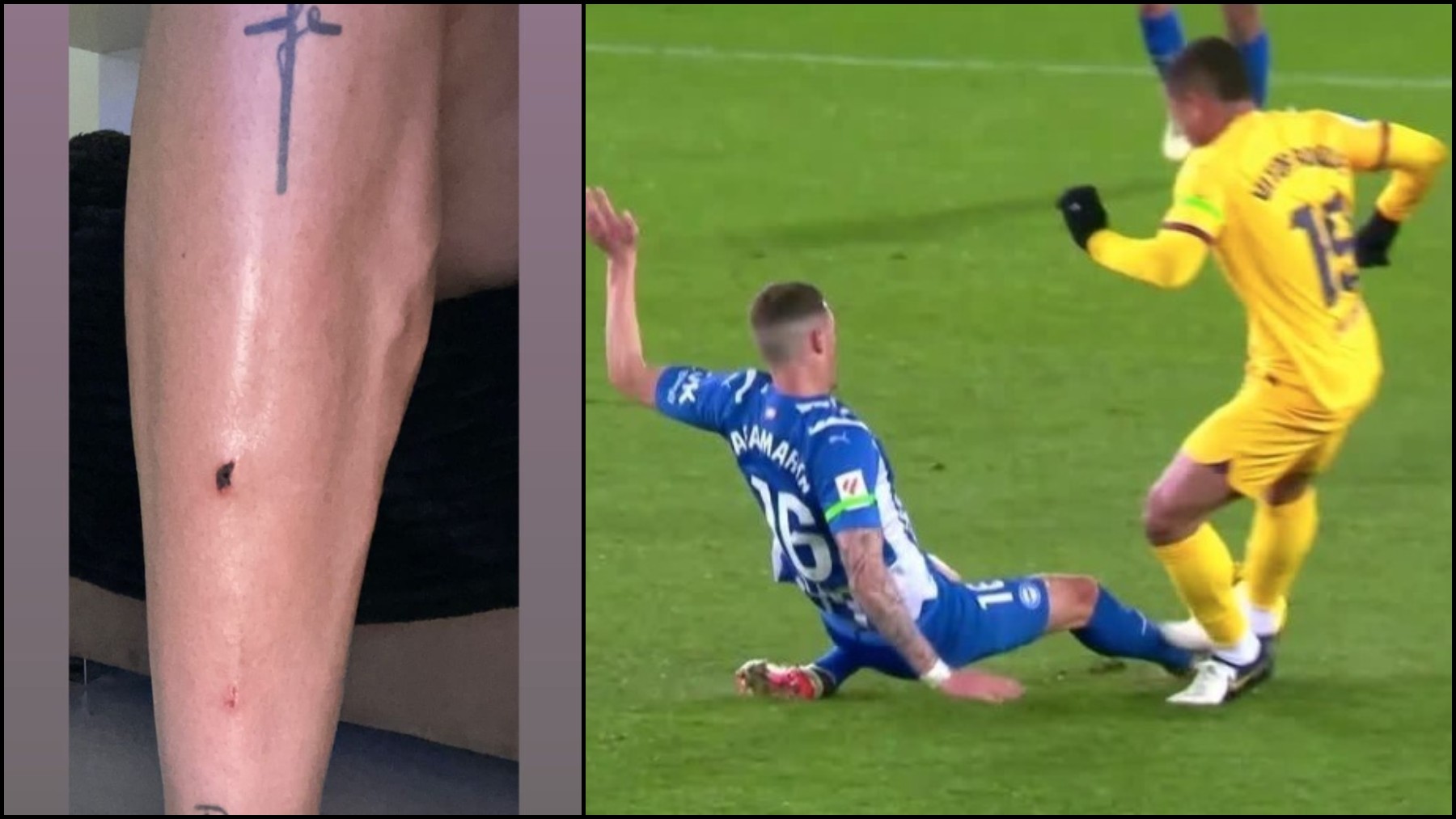 Rafa Marín publicó la imagen de su pierna tras la falta de Vitor Roque.
